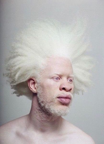 albino juodaodis