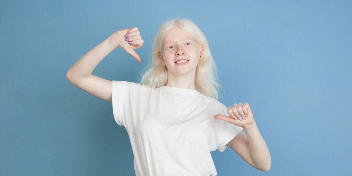 albino mergina