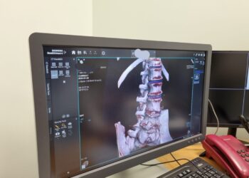 Modernus kompiuteris tomografas Šakiuose