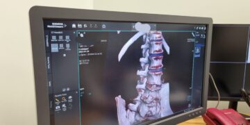 Modernus kompiuteris tomografas Šakiuose