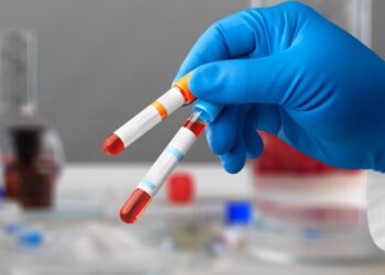 Mažakraujystė - nereta diagnozė ir lietuvių tarpe