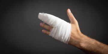 Šakietis patyrė pirštos traumą