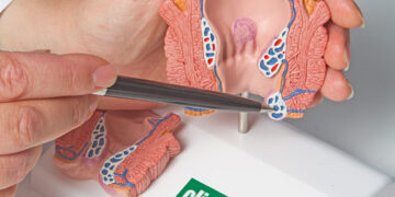 Lėtinis prostatitas – viskas, ką reikėtų žinoti