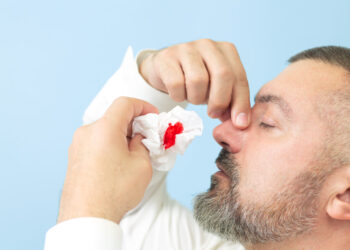 Kraujavimas iš nosies