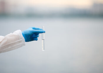 Patašinėje atliekamas tyrimas dėl galimai užteršto vandens