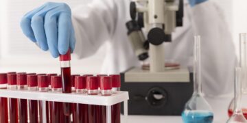 Kraujo tyrimai