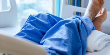 Šaltis itin pavojingas galūnėms