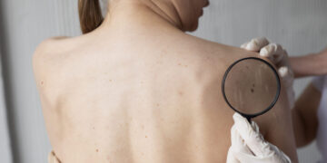 Odos darinių patikra