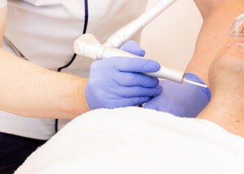 Svarbiausia dalykai, kuriuos reikia žinoti apie sąramas