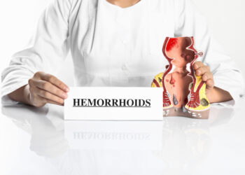 Jei kamuoja hemorojaus simptomai – laukti nevalia