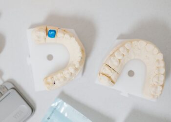 Dantų implantacija – investicija į jūsų ateitį