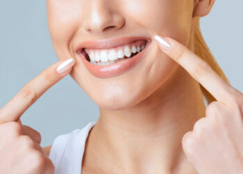 Ką reikia žinoti apie dantų balinimą?