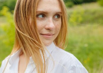 Strazdanos vasarą: kodėl jų padaugėja ir kaip prižiūrėti savo odą?