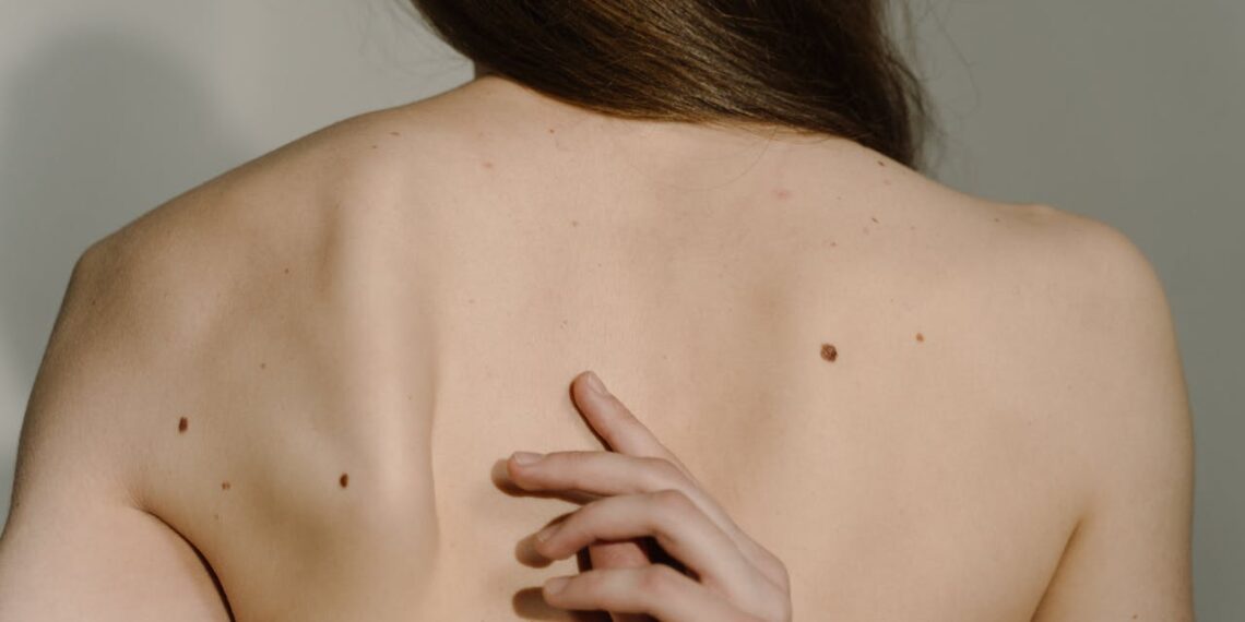 Dermatologas