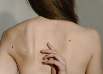 Krioterapija – kas tai ir kaip ji veikia žmogaus organizmą