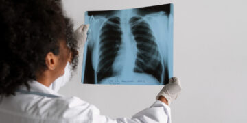 Rentgeno nuotraukos peržiūra